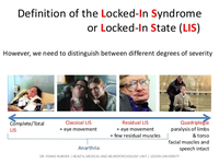 frequently-asked-questions-about-the-lockedin-syndrome-3-6388b2b1a.png